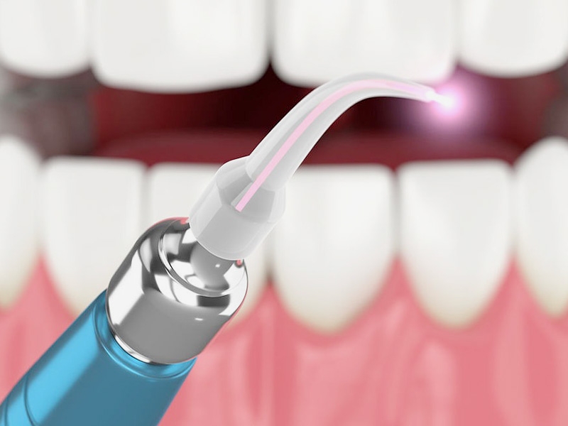 レーザー治療を行っております